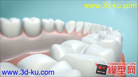 牙齿精模模型的图片1