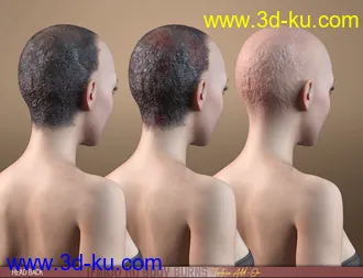 3D打印模型HD Body Burns Add-On for Genesis 8 and 8.1 Females的图片