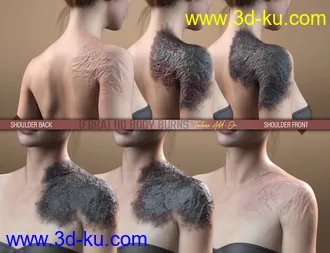 HD Body Burns Add-On for Genesis 8 and 8.1 Females模型的图片12