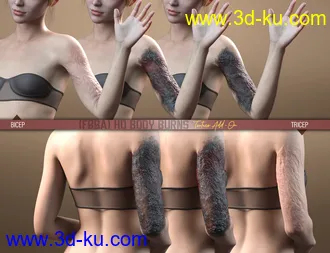 3D打印模型HD Body Burns Add-On for Genesis 8 and 8.1 Females的图片