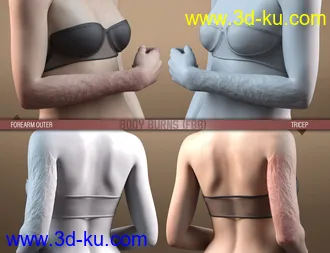 3D打印模型HD Body Burns for Genesis 8 and 8.1 Females的图片