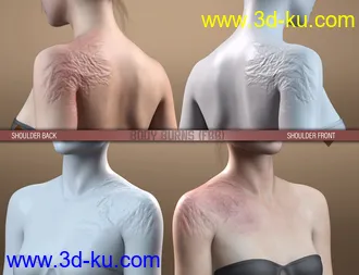 3D打印模型HD Body Burns for Genesis 8 and 8.1 Females的图片