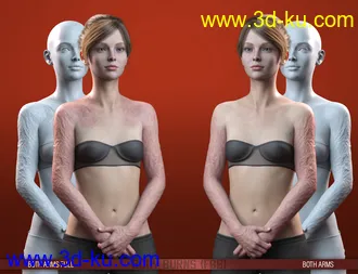 3D打印模型HD Body Burns for Genesis 8 and 8.1 Females的图片