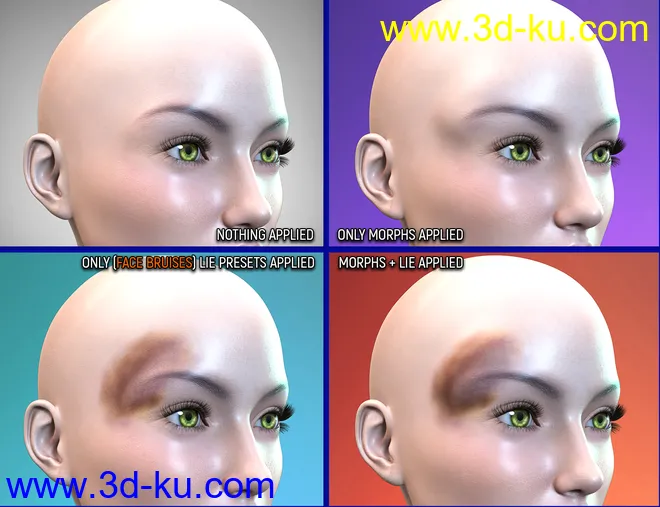 Face Bruises Morphs for Genesis 3 & 8 Female(s)模型的图片9
