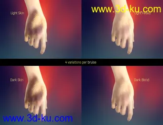 3D打印模型LIE Body Bruises for Genesis 3 and 8 Female(s)的图片