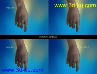 3D打印模型LIE Body Bruises for Genesis 3 and 8 Female(s)的图片