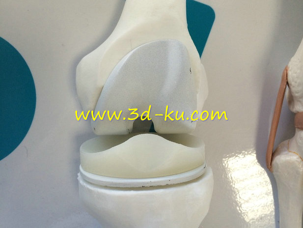 膝关节假体模型的图片1