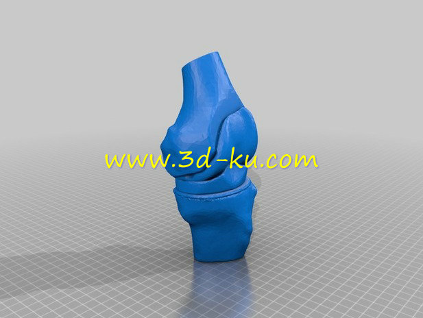 膝关节假体模型的图片3