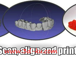 3D打印模型牙科里的三维建模的图片