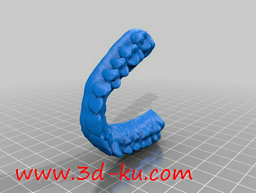 3D打印模型牙科里的三维建模的图片