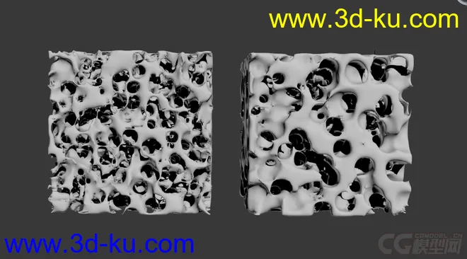 医学模型 骨质疏松的图片2