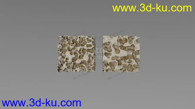 骨质疏松  Osteoporosis   C4D模型的图片2